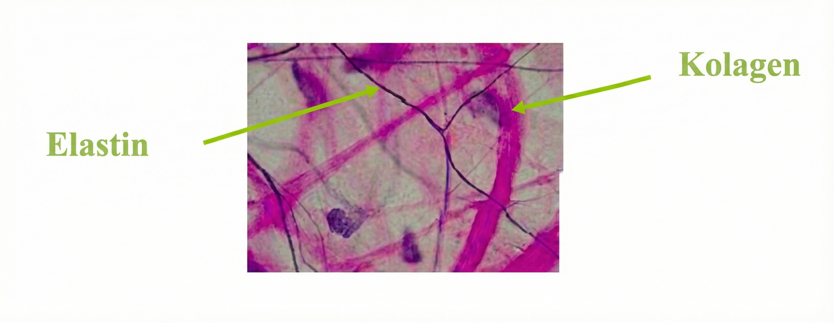 Elastin a kolagen
