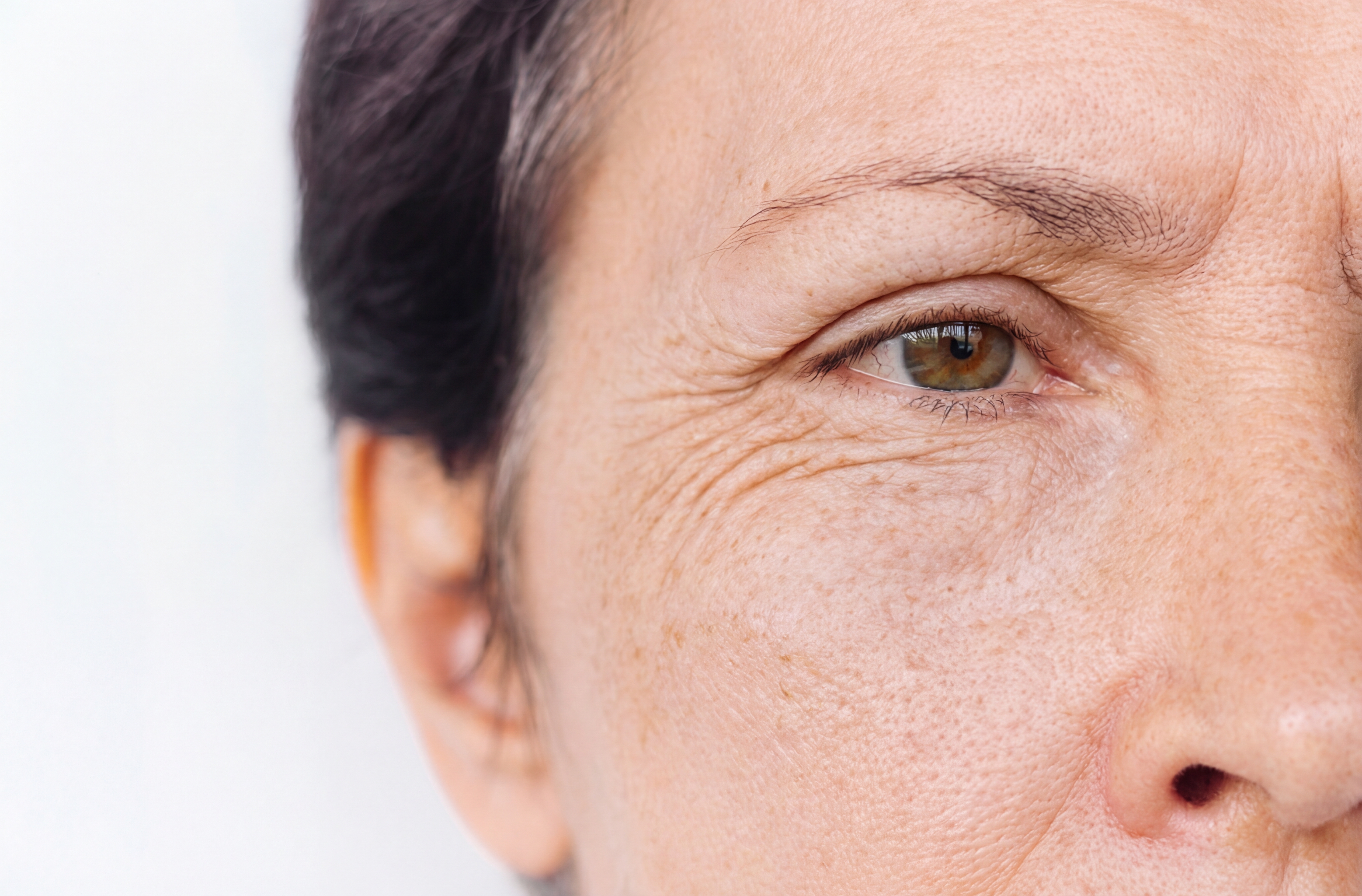 Vrásky na obličeji