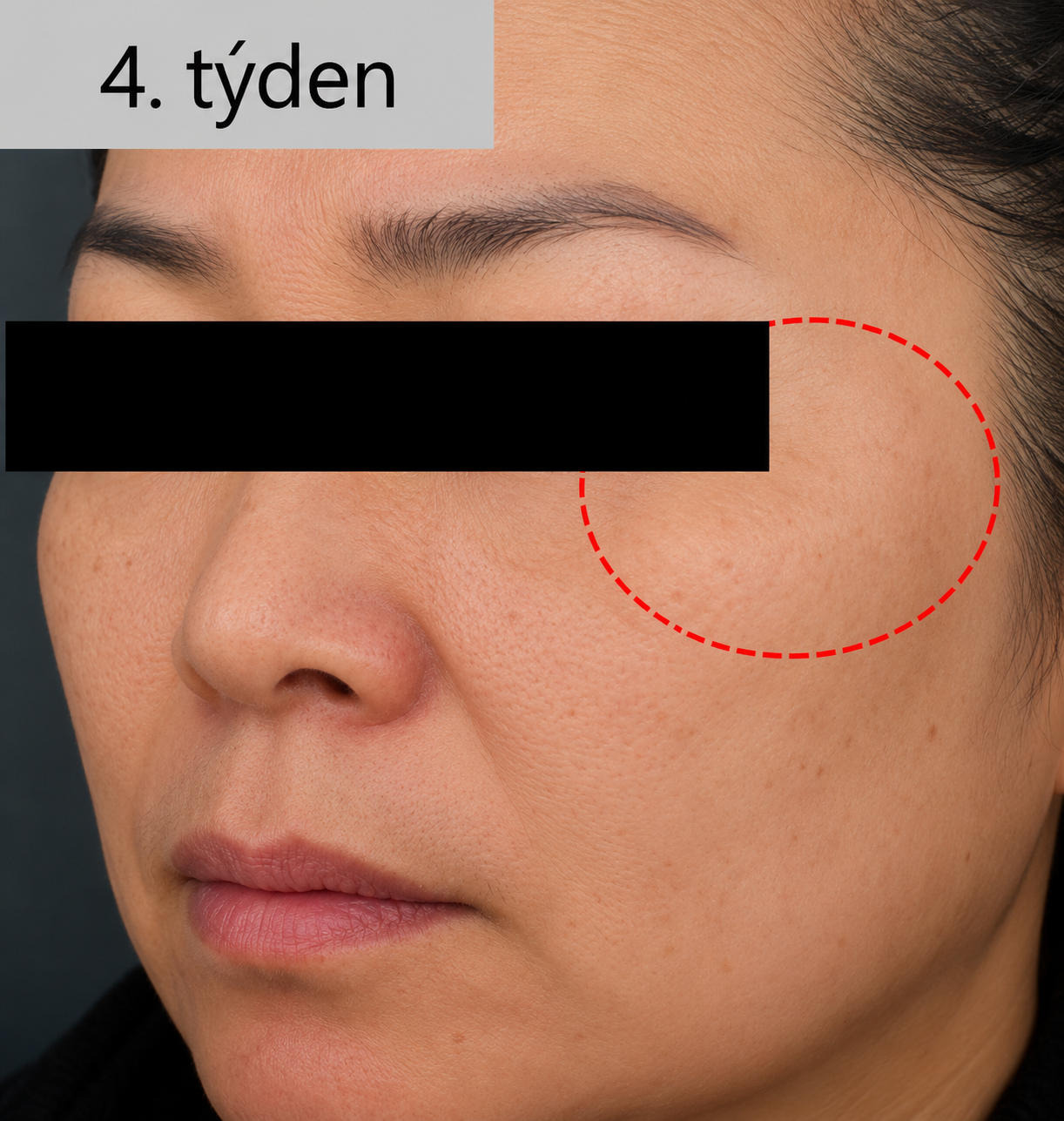 Pacient 2 – 4. týden