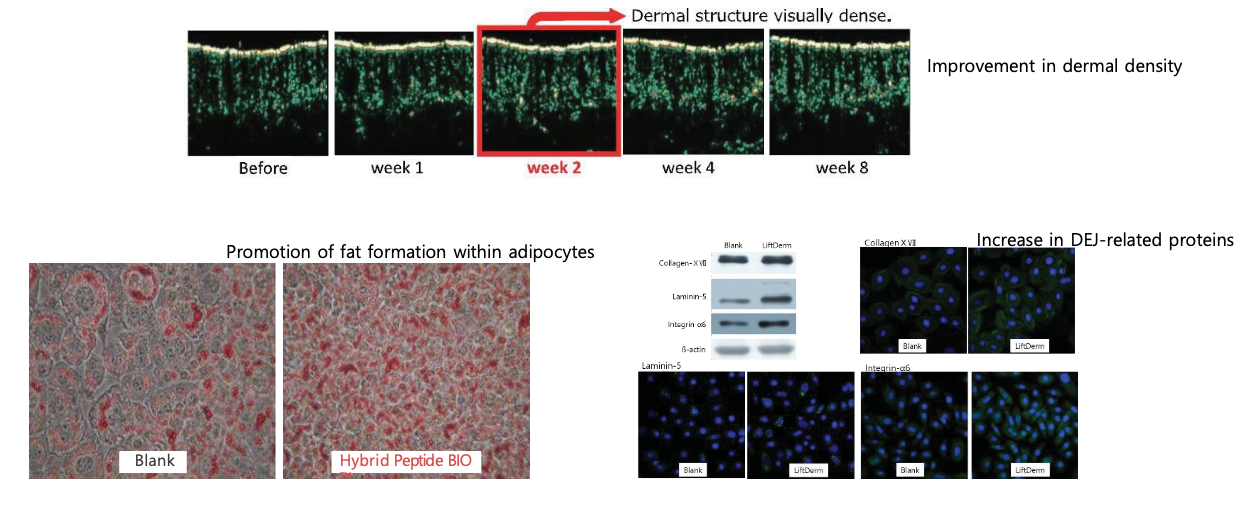 Časová řada hustoty dermis (Before–week 8) + adipocyty Blank vs Hybrid Peptide BIO + western blot DEJ proteinů