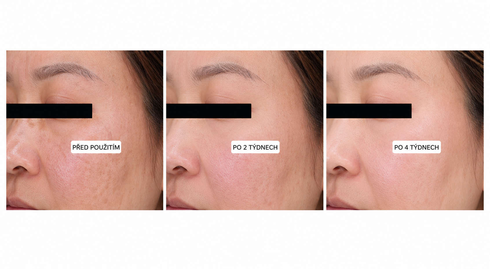 3 fotky pleti — before/after vrásek u oka